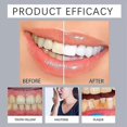 thumbnail image 2 of Pasta de dientes remineralizante Larineco Gum 1-3X 2 piezas Yuxing, 2 of 5