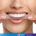 Crest 3D Whitestrips, Professional Effects, Teeth Whitening Strip Kit