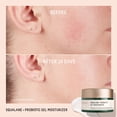 thumbnail image 4 of Hidratante Biossance Squalane + Gel equilibrante probiótico 50 ml, 4 of 8