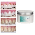 thumbnail image 3 of Kit de reparación de relleno dental temporal Perlas de relleno dental térmico Adhesivo dental para 250ml, 3 of 9