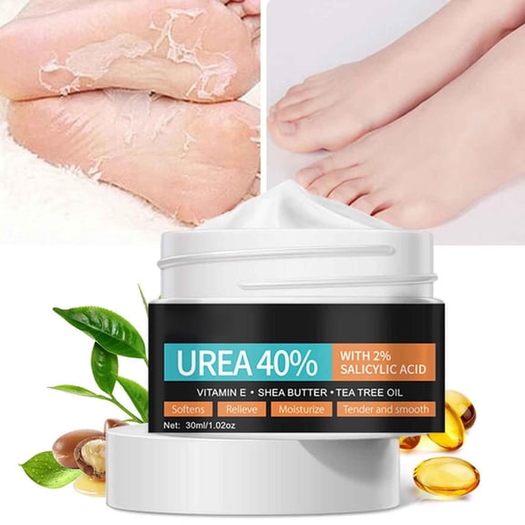 Banzch Urea Cream 40% | 2% Salicylicacid | Intensive Urea Foot Cream & Callus Remover | With Aloevera And Teatree Oil For Deep Moisturing And Skin Softening 30ml,Mothers Day Gifts