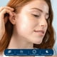 thumbnail image 2 of Parches para espinillas CLEAN SKIN CLUB Derma Dot Hydrocoloid Vegan, 2 of 7