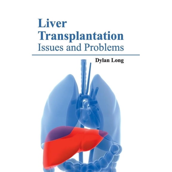 Liver Transplantation: Issues and Problems, (Hardcover)