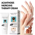 thumbnail image 4 of Crema correctora de manchas oscuras crema portátil de acantosis nigricans para nudillos ANGGREK Otros, 4 of 8