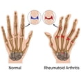 thumbnail image 3 of Guantes Magnéticos Para Terapia Antiartritis, Guantes Magnéticos Sin Dedos, Medio Dedo, 1 Par, 3 of 8