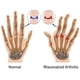 thumbnail image 3 of Guantes Magnéticos Para Terapia Antiartritis, Guantes Magnéticos Sin Dedos, Medio Dedo, 1 Par, 3 of 8