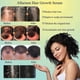 thumbnail image 4 of 3 unidades de sérum capilar natural a base de hierbas para un cabello más grueso y abundante, y tratamiento anticaída., 4 of 5