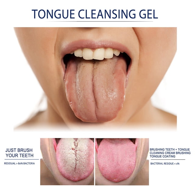 Limpiador de Lengua ANGGREK Raspador de Lengua Con Gel 50g Cuidado Bucal