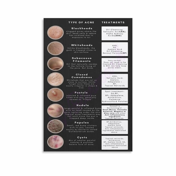 Types of Acne Dermatology Posters Canvas Painting Posters And Prints Wall Art for Living Room Bedroom Decor