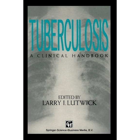 Tuberculosis, (Paperback)