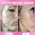 thumbnail image 5 of It Girl Skin Glow Gummies for Women, Collagen Peptides, Retinol, Antioxidants, Sea Moss, Skincare Superfoods, Vitamins & Minerals, Fatty Acids, 60 Ct, 5 of 16