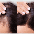 thumbnail image 3 of Natural Hair Growth Oil | Hair Growth Serum | For 1A-4C type hair | Pre-poo treatment oil | Thicker & Longer Hair| Hair Treatment Growth Oil, 3 of 3