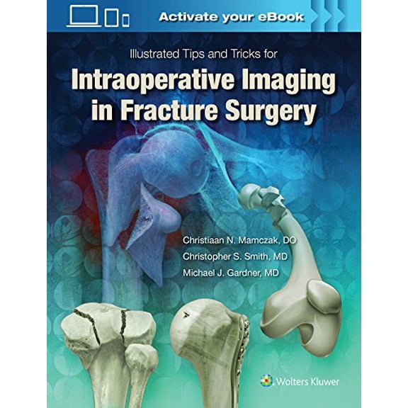 Pre-Owned Illustrated Tips and Tricks for Intraoperative Imaging in Fracture Surgery, 9781496328960, 1496328965, Hardcover, First Edition edition