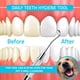 thumbnail image 3 of Herramienta profesional de raspador de sarro dental - Selección dental, removedor de sarro de doble extremo para dientes, removedor de placa, raspador de dientes Vhermosa CZMR-ZC140, 3 of 6