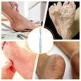 thumbnail image 3 of Foot File Callus Remover Long Handled Toe Cleaning Brush Foot File  Callus Remover Foot Scrubber Toe Crevice Cleaning Brush Foot Care Pedicure Tool, 3 of 6