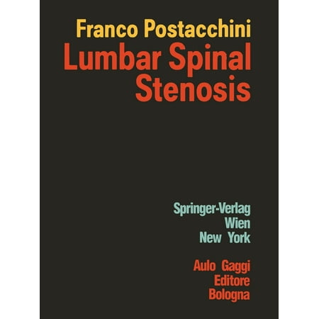Lumbar Spinal Stenosis (Best Way To Treat Spinal Stenosis)
