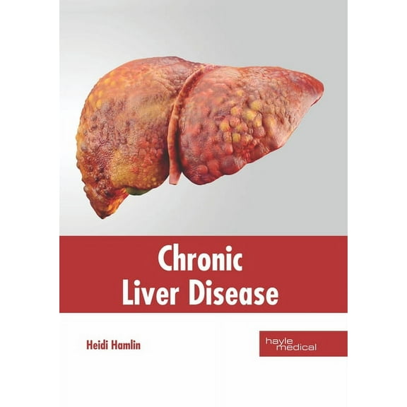 Chronic Liver Disease, (Hardcover)