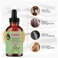 Xerdsx Rosemary Mint Scalp & Hair Strengthening Oil With Biotin & Essential Oils, Nourishing