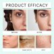 thumbnail image 3 of Crema iluminadora y aclaradora de manchas, gel hidratante, calmante e hidratante, reparador multiefecto, piel sensible, envase portátil de 50 g, 3 of 4