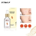thumbnail image 1 of Fiudx Ofertas Del Día Hidratante Y Hidratante Hidratante 15Ml, 1 of 5