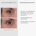 thumbnail image 3 of Murad Targeted Eye Depuffer – Ginseng, Lily, and Caffeine Eye Cream Fights Fatigued and Stressed Appearance by Brightening, Depuffing, and Firming Under-Eye Bags – 0.5 Fl Oz, 3 of 8