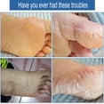 thumbnail image 2 of 5 Pairs Moisturizing Gel Heel Socks Open Toe Socks for Dry Hard Cracked Heels, 5 Colors, 2 of 8