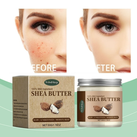 Up to 60% Off! Gspmoly Moisturizer, Shea Deeped Nourishing Cream for Body and Face Moisturises and Hydrates Without Irritation Face Cream
