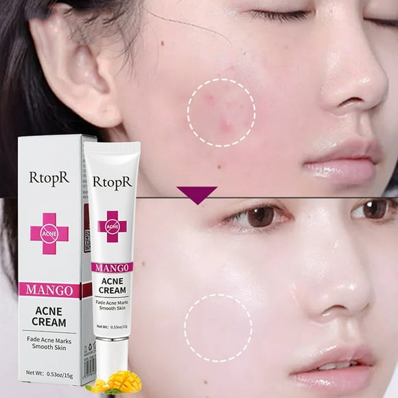 Fiudx Crema Reparadora, Eliminadora de Cicatrices y Marcas, Reductora de Líneas Finas y Arrugas, Eliminadora de Ojeras E Hinchazón, Nutre E Hidrata La Piel, Apta para Todo Tipo de Piel, Fórmula Poten