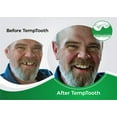 Temptooth #1 Seller Temporary Tooth Replacement Kit, Missing Tooth Kit ...