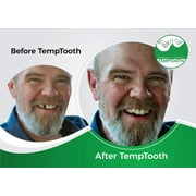 Temptooth #1 Seller Temporary Tooth Replacement Kit, Missing Tooth Kit, DIY Tooth Replacement, Affordable Dental Repair, Emergency Missing Tooth Fix