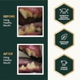 thumbnail image 4 of VetriScience Dental Care Powder for Dogs & Cats, 4.2 oz, 4 of 9