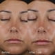 thumbnail image 4 of Protector solar Image Skincare DAILY PREVENTION SPF 50 75 ml, 4 of 8