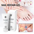 thumbnail image 3 of Healio Nail Treatment Gel ,foot Care Gel Anti Infection Thicken Soft Nails, 3 of 5