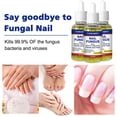 thumbnail image 3 of 3pcs Anti Fungal Treatment Fungus Effective Finger Toe Nail Repair Liquid Solution, 3 of 5