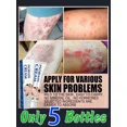 thumbnail image 2 of Ungüento de Psoriasis a base de hierbas naturales, tratamiento de Dermatitis, Eczema, crema antibacteriana, cuidado antiprurítico DE LA PIEL, 2 of 5