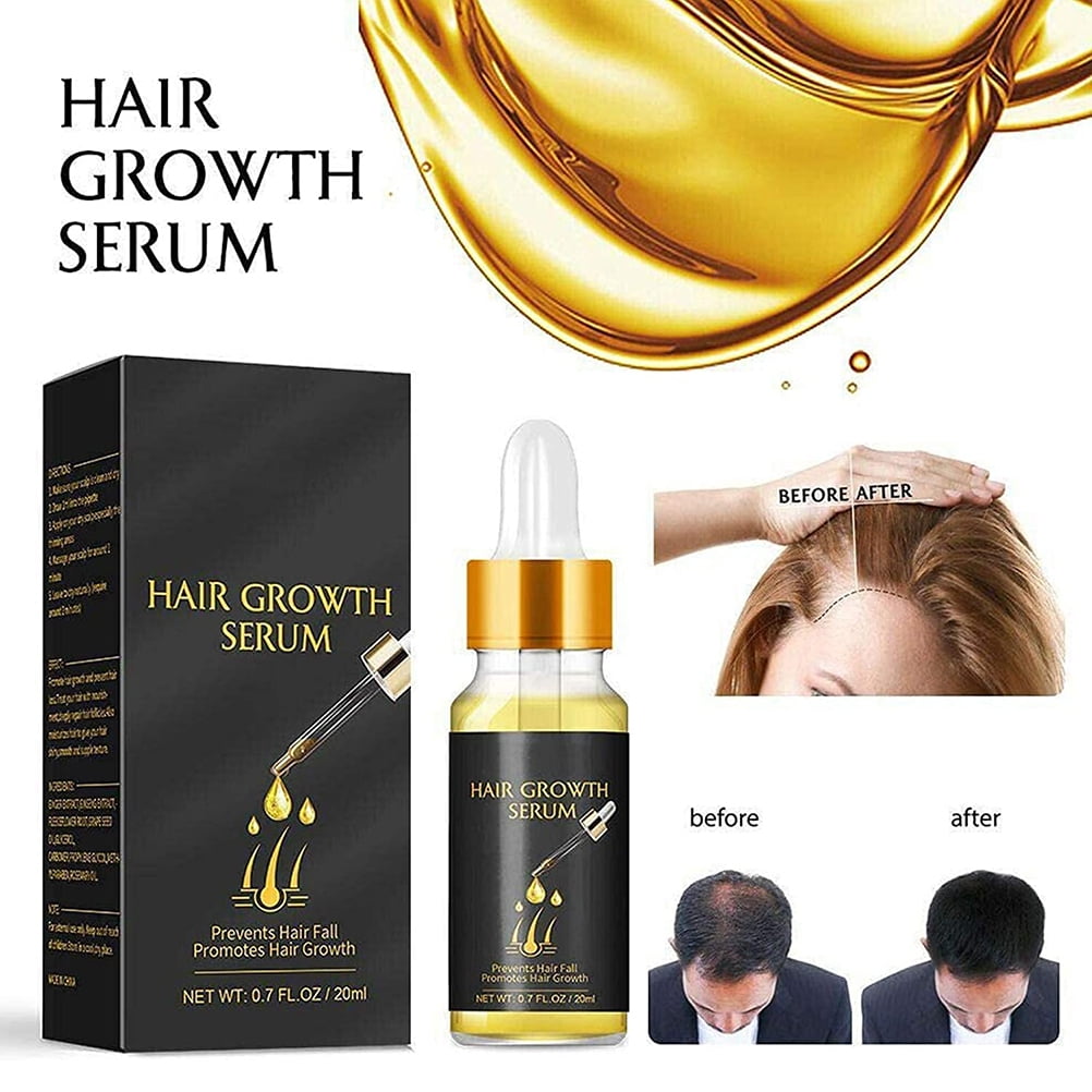 Biotin Thickening Herbal Serum Fast Hair Growth Serum Oil Ginger Hair  Growth Serum Hair Loss Serum Oil | Walmart Canada