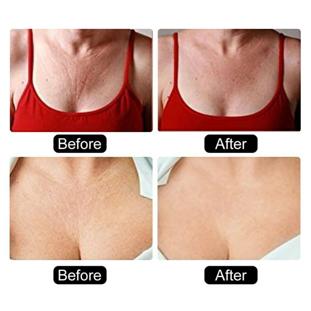 TOPINCN Anti-Wrinkle Silicone Chest Pad Invisible Decollete Bra