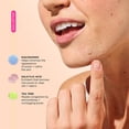 thumbnail image 3 of Pimple Patches ZitSticka GOO GETTER para rostro y cuerpo, paquete de 36, 3 of 7
