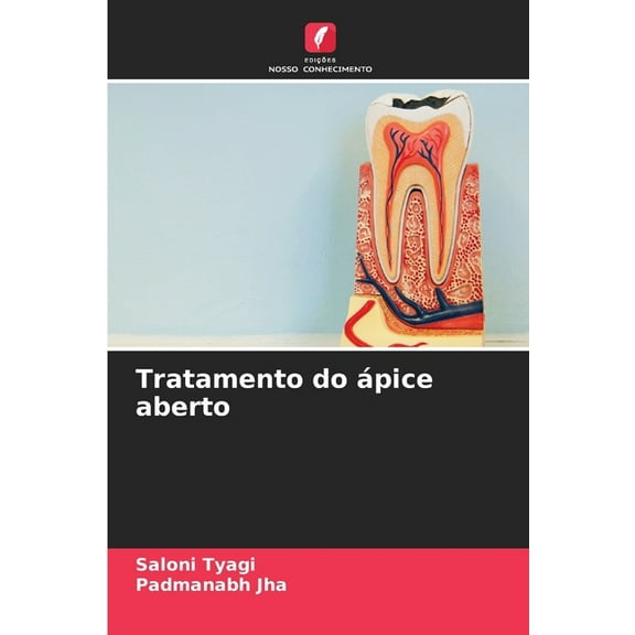 Tratamento do Ã¡pice aberto, (Paperback)