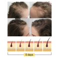 thumbnail image 5 of Barra de champú de jengibre anticaída de JAYSUING, 1 unidad, aceite equilibrante que aumenta el volumen del cabello y nutre la raíz del cabello para el crecimiento del cabello, 5 of 5
