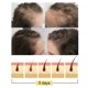 thumbnail image 5 of Barra de champú de jengibre anticaída de JAYSUING, 1 unidad, aceite equilibrante que aumenta el volumen del cabello y nutre la raíz del cabello para el crecimiento del cabello, 5 of 5