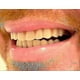 thumbnail image 4 of Instant Smile Comfort Fit Flex Teeth - Upper and Lower Matching Set Natural), 4 of 4