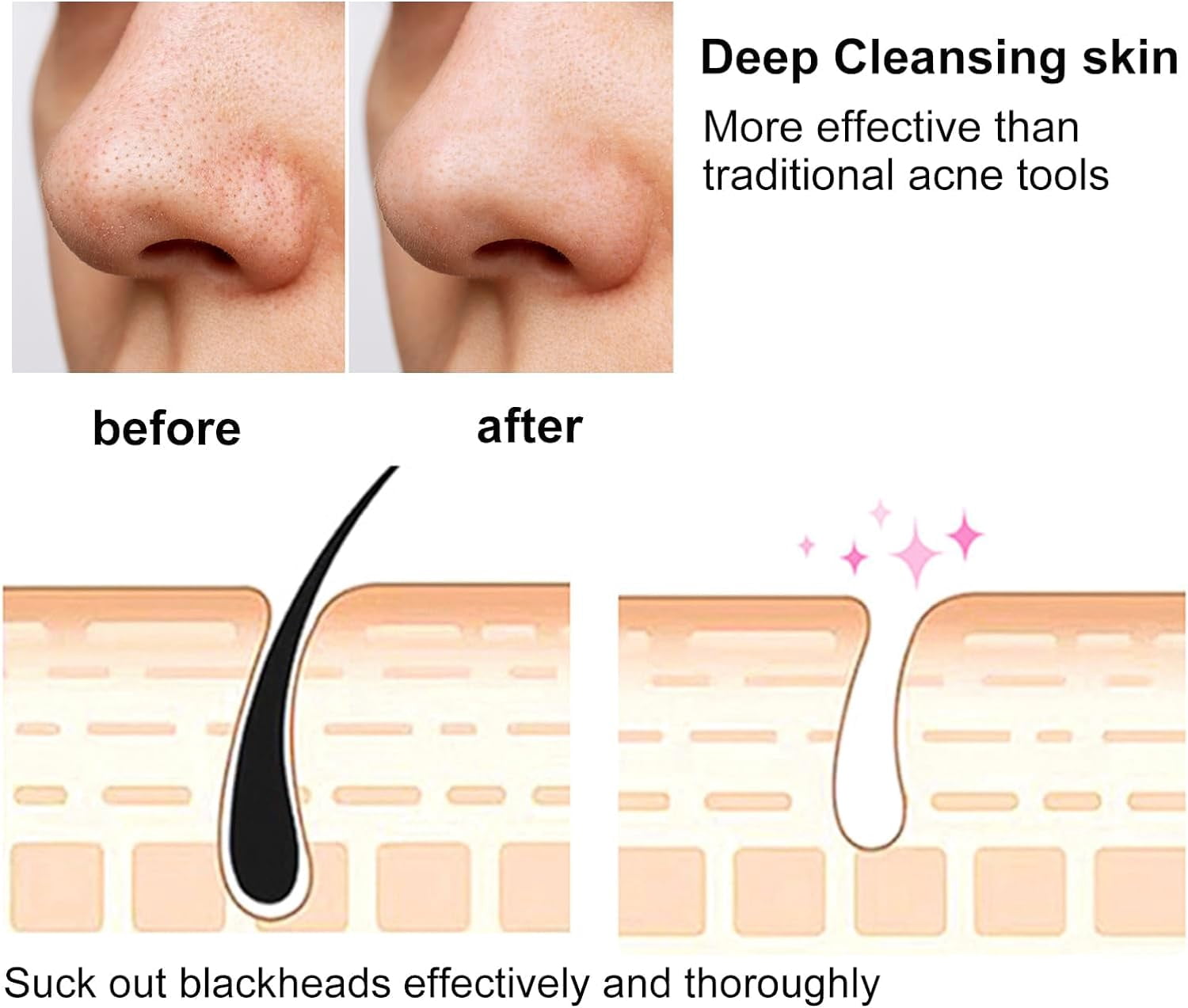 Blackhead Removal Tool with Hot Compress, 3 Adjustment Modes & 4 Suction Heads Pore Vacuum,Facial Pore Cleanser
