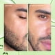 thumbnail image 4 of Toner Farmacy Deep Sweep Gentle BHA 2% Ácido salicílico 120 ml, 4 of 9
