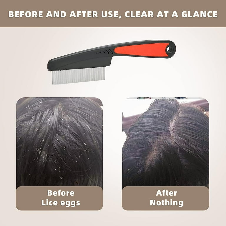 Dandruff comb cheap