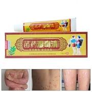 15g Fungus Anti Bacterial Cream Natural Chinese Herbs Cream Ointment for Psoriasis Dermatitis Eczema Treatment