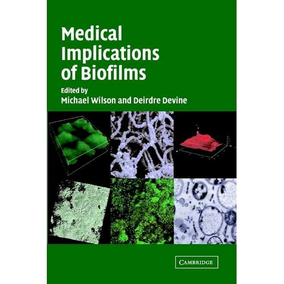 Medical Implications of Biofilms, (Hardcover)