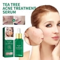 thumbnail image 2 of Hot selling goods!Acne Moisturizing Pore Tightening Acne Facial Skin Care Products,17ML, 2 of 9