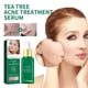 thumbnail image 2 of Acne Moisturizing Pore Tightening Acne Facial Skin Care Products,17ML, 2 of 5