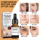 thumbnail image 4 of Suero facial de 10 ml con extracto puro, hidratante, antiedad, reafirmante, suave y masajeador esencial., 4 of 5